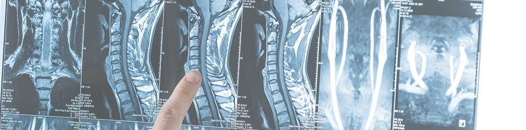 Precise Diagnosis