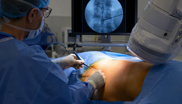 Long-Lasting Pain Relief Through a Minimally Invasive, Targeted Approach