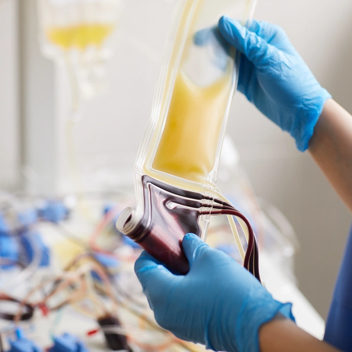 Regenerative Therapies