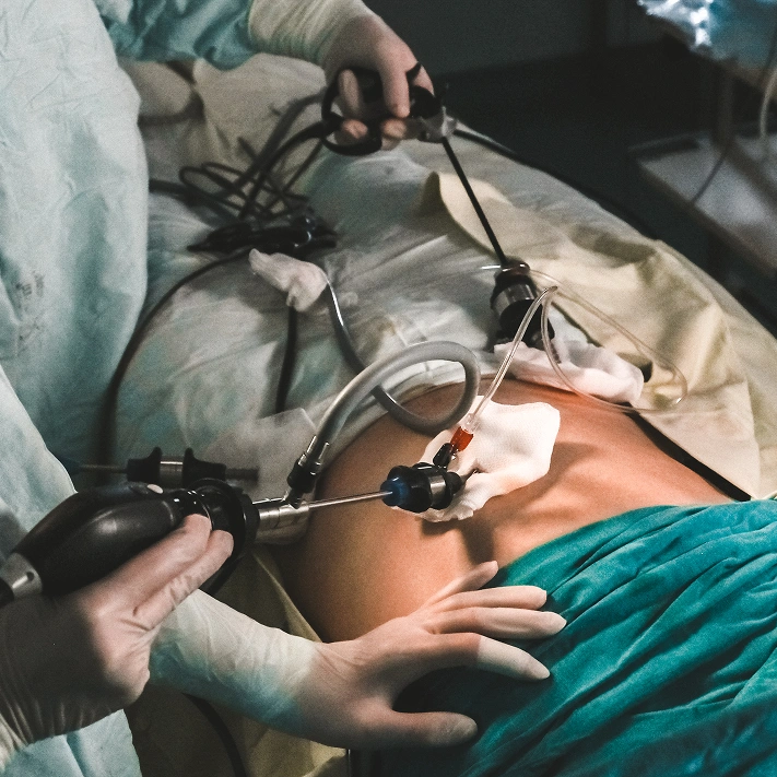 Minimally Invasive Spine Endoscopic Pain Procedures