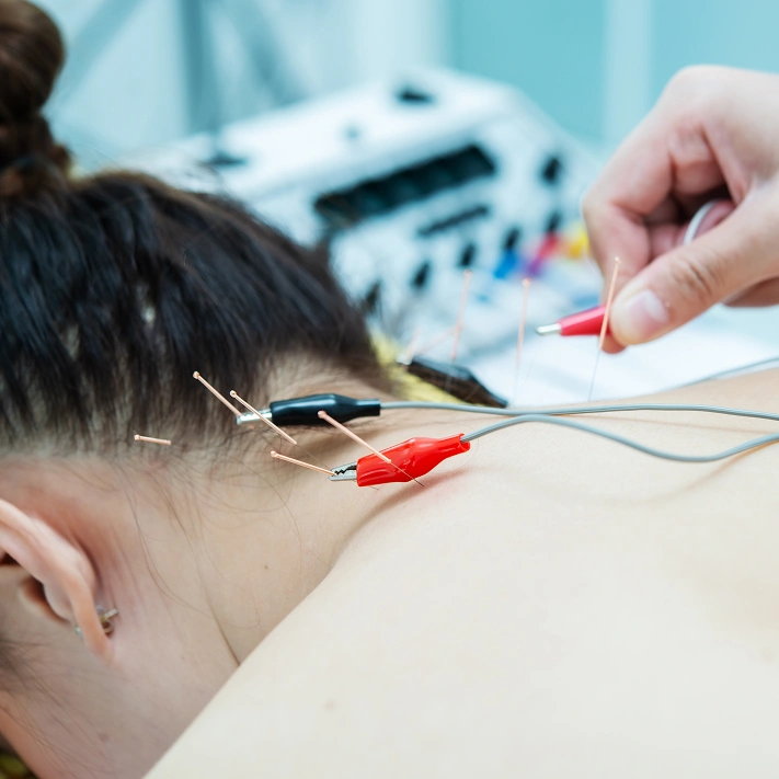 Neuromodulation