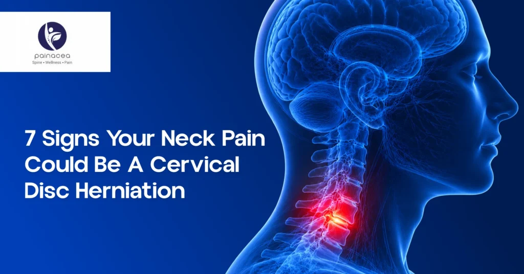 7 Signs Your Neck Pain Could Be a Cervical Disc Herniation