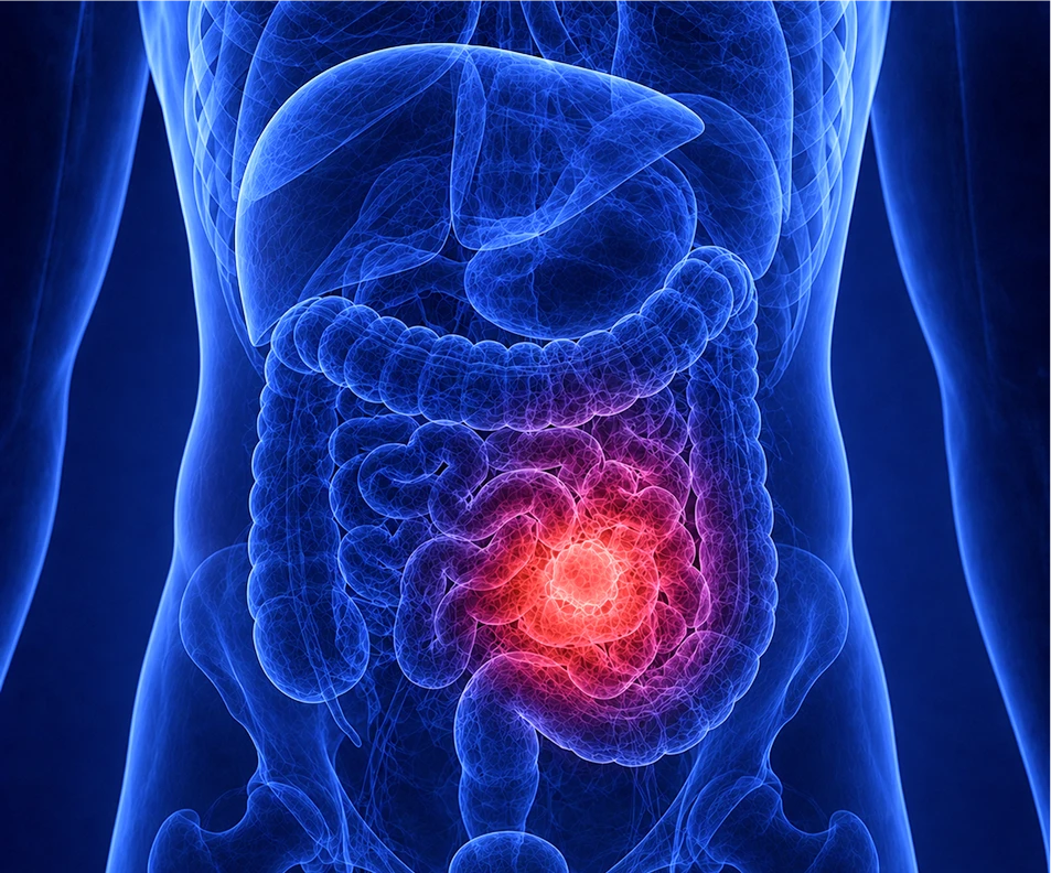 Abdominal Cancer Pain