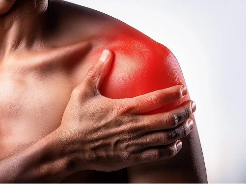 What Is a Frozen Shoulder? 