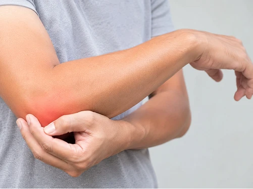 What Is Golfer’s Elbow?