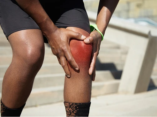 What Is Patellofemoral Pain Syndrome?