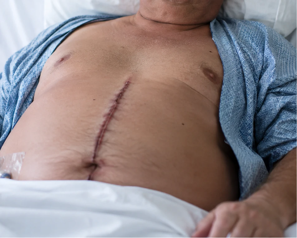 What Are the Causes of Post Surgery Abdominal Pain?