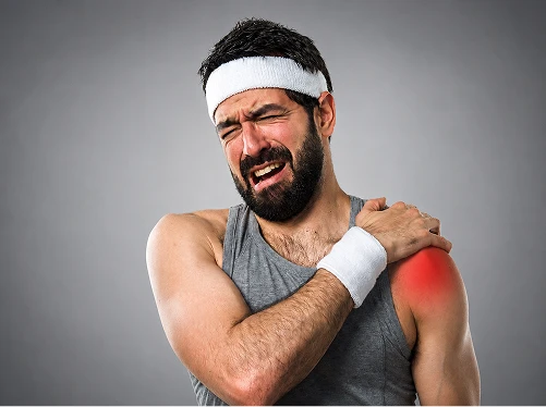 What Is a Rotator Cuff Tear?