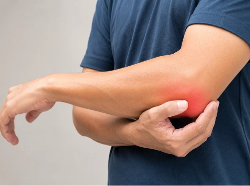 What Is Tennis Elbow?