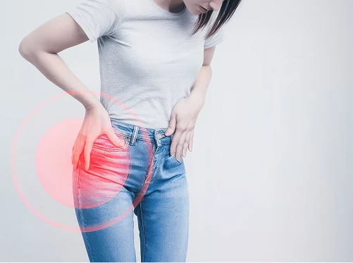 What Is Trochanteric Bursitis?