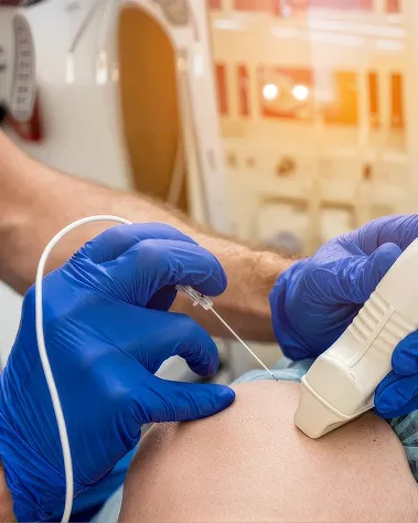 Radiofrequency Ablation