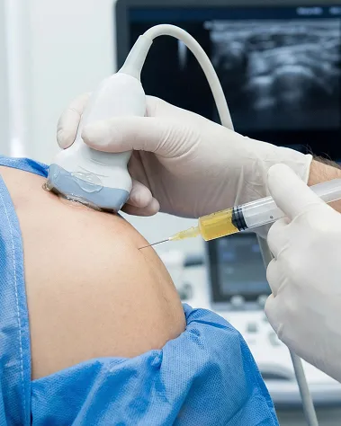 PRP Therapy