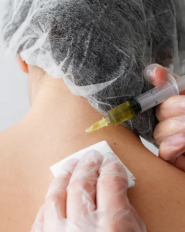 PRP Therapy