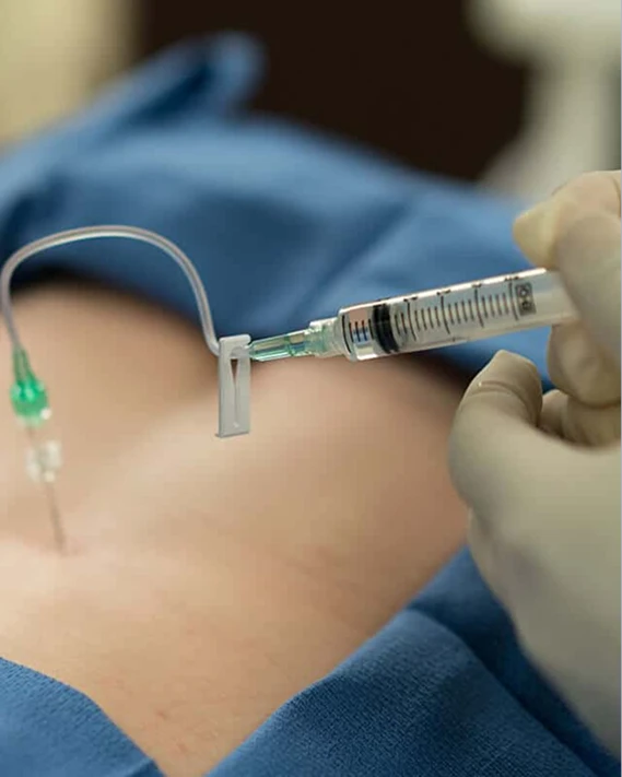 Epidural Steroid Injections