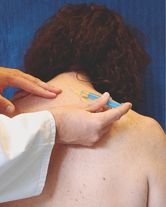 Nerve Blocks
